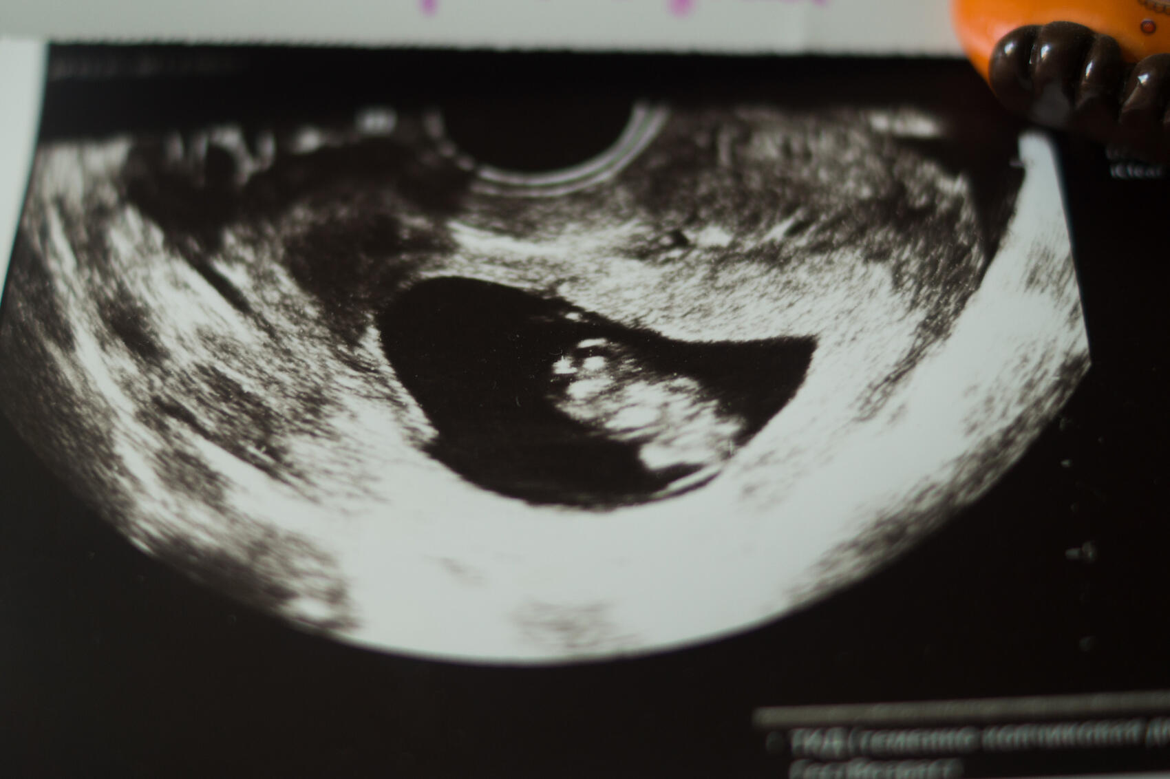 Фото: Елена Елизарова / It’s My&nbsp;City