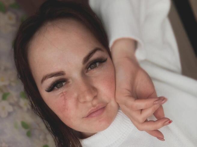 Елизавета Овчинникова. На лице виден шрам от пореза бутылкой. Фото: E1.ru